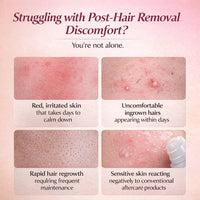 Roll-On Cyperus Rotundus Essential Oil for Hair Removal Care, Moisturizing Soothing Skin